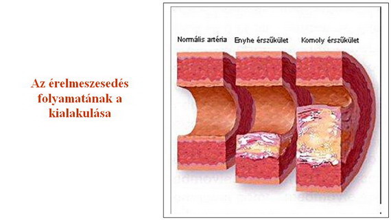 sz__k__let_570.jpg